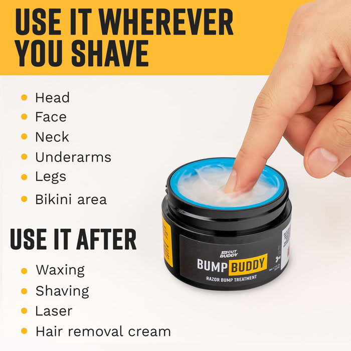 Bump Buddy - Razor Bump Treatment, 1.7 fl oz (50mL)