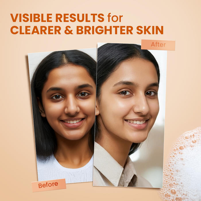 Kojic Acid Detan & Brightening Soap