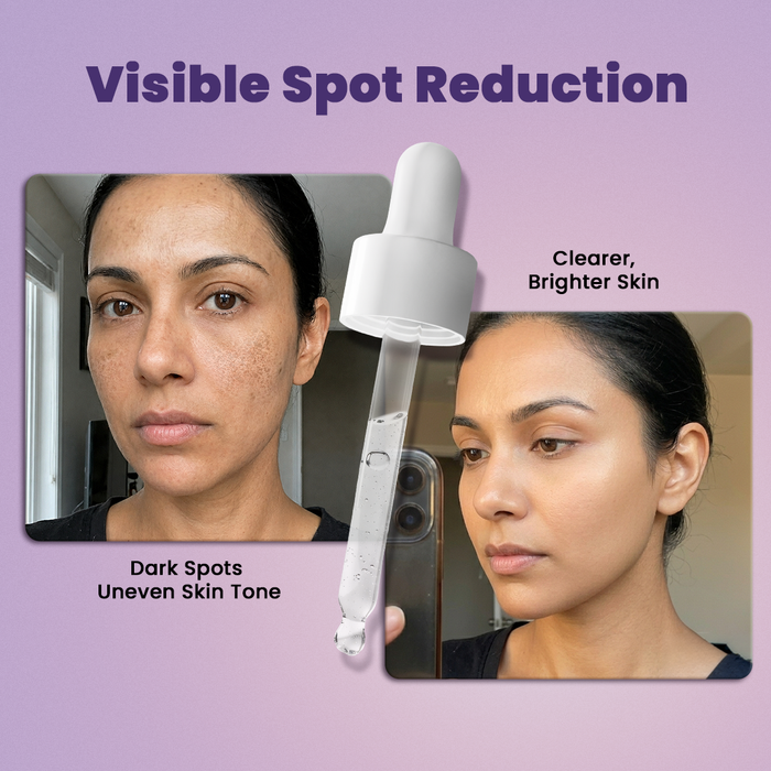 Vedscience Dark Spot Serum - 30 ml