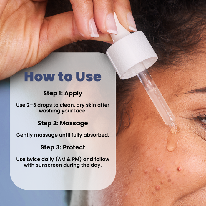 Vedscience Oil Control Serum - 30 ml